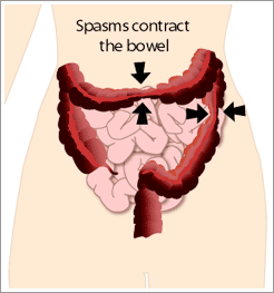 Irritable Bowel Syndrome Treatment is Possible! bowel diagram
