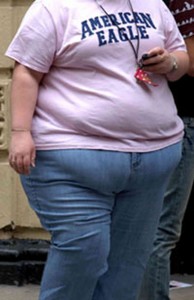 is there a gastric bypass diet obese woman
