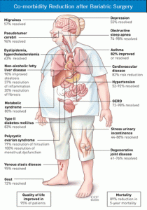 should i have weight loss surgery chart