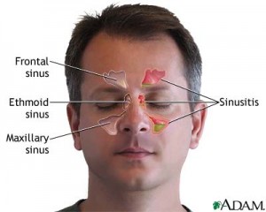 sinus chart